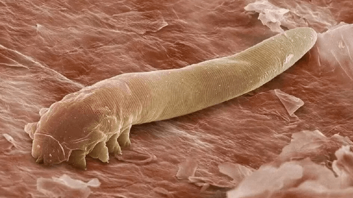 Parasites in the human body