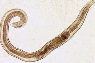 A person's parasite