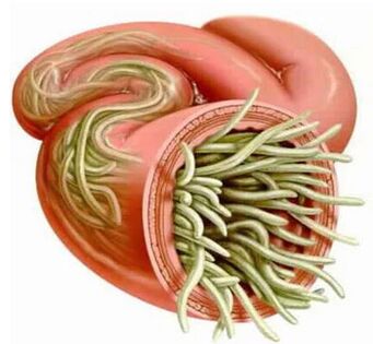 Human parasite symptoms and treatment