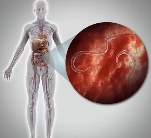 Parasites in the human body