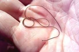 Parasitized in your palm