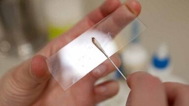 Calais analysis to identify parasites