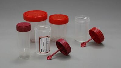 How to prepare for parasite tests