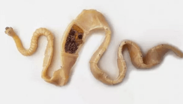 How to detect the existence of parasites in the body