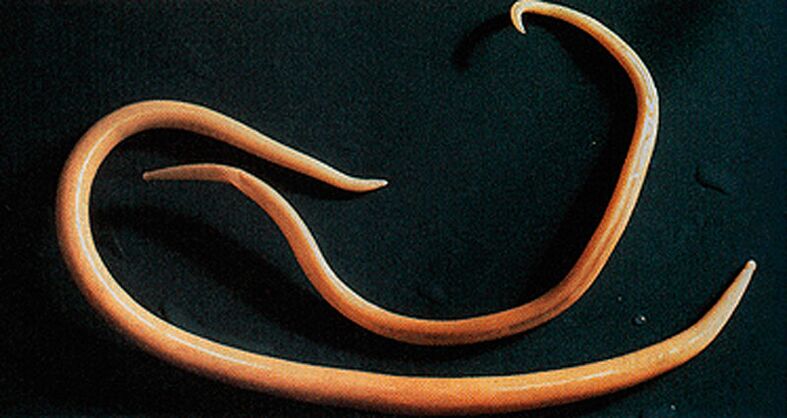 helminth parasites from the human body